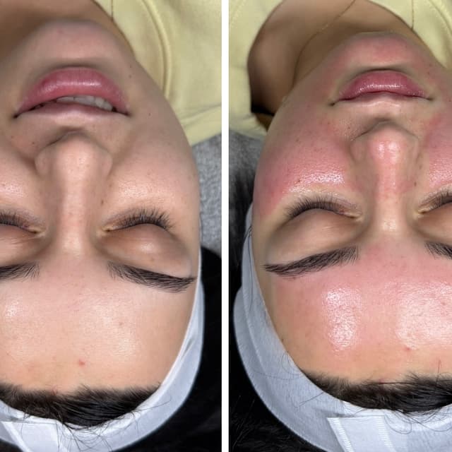 MN and Glow (prior to 4/19/2026) at Southern Sparkle Medical Aesthetics in Swainsboro, GA